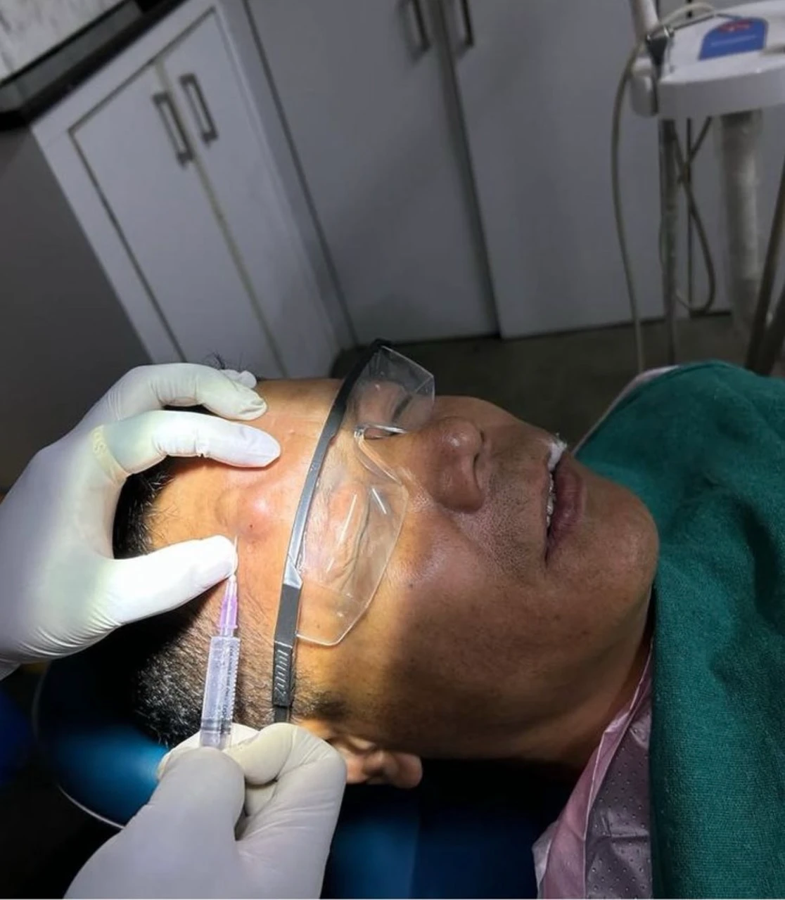 In Progress Image of Cyst Removal Surgery